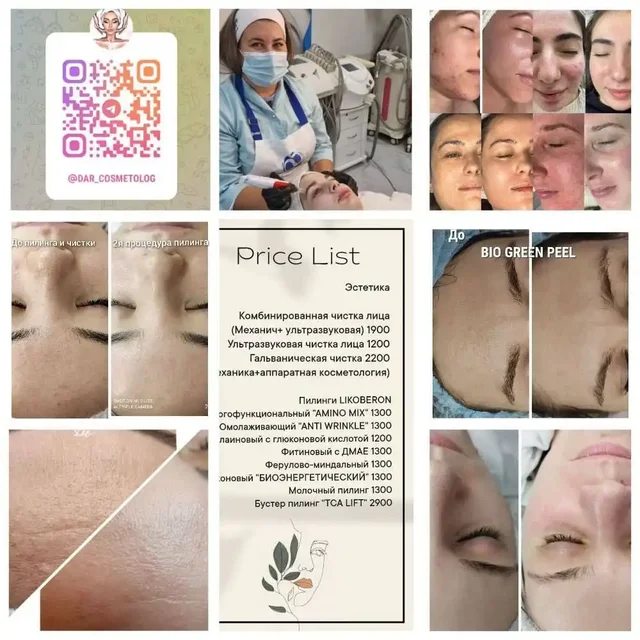 Требуются модели на пилинг и чистку лица - Флористика в Ангарск