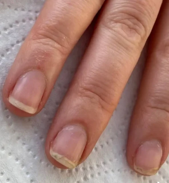 Профессиональный маникюр и уход за ногтями в Ангарске - Косметология в Ангарск