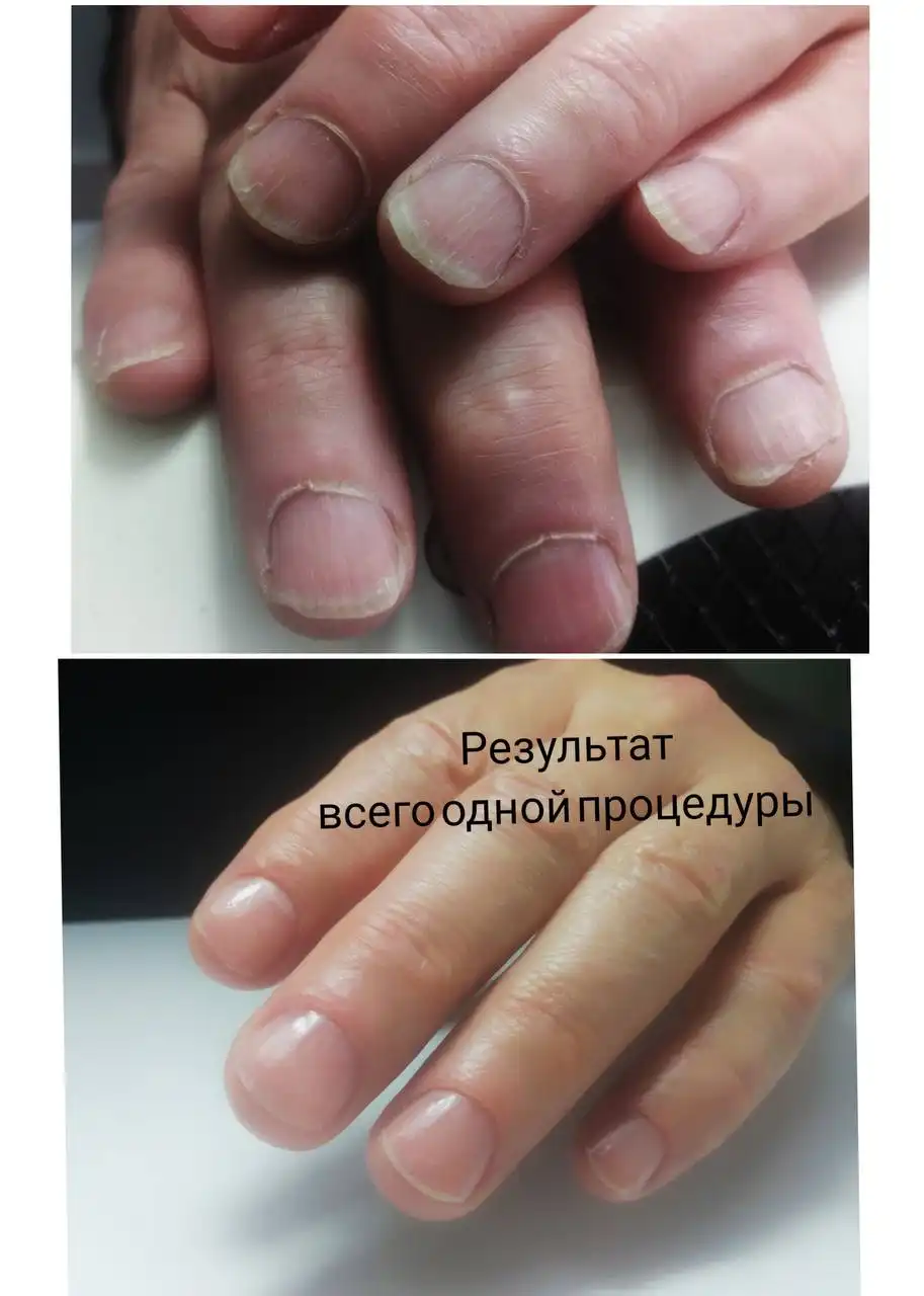 Профессиональный маникюр и уход за ногтями в Ангарске - Маникюр (Услуги) в Ангарск