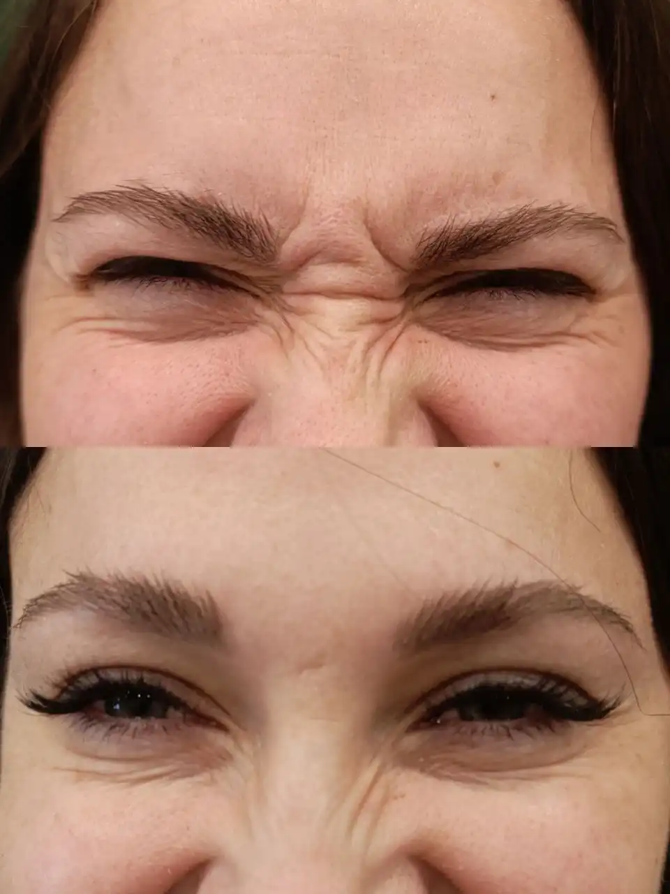 Косметологические услуги от Елены Чиркай - Косметология (Красота и здоровье) в Ангарск