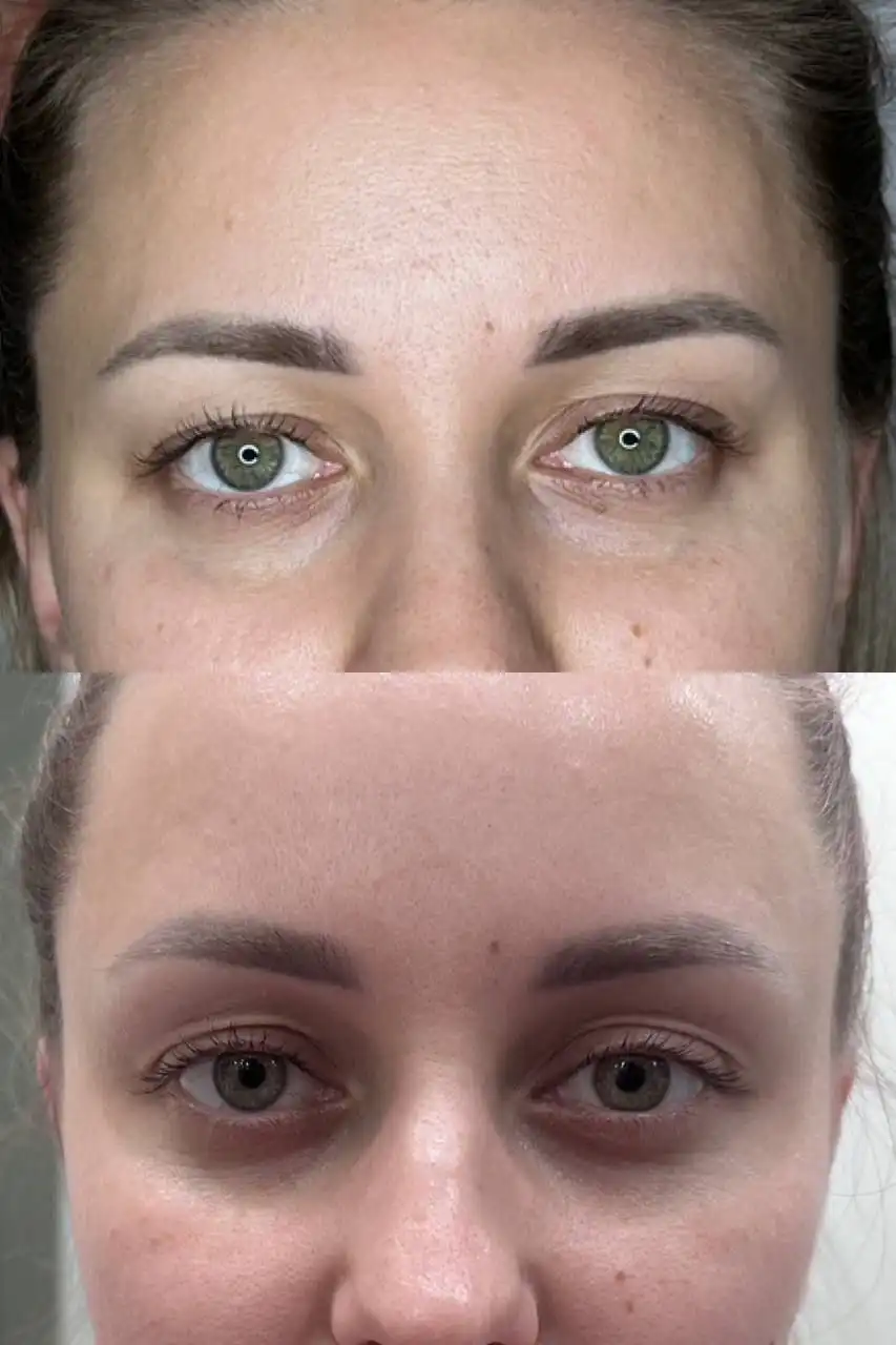 Косметологические услуги от Елены Чиркай - Косметология (Красота и здоровье) в Ангарск