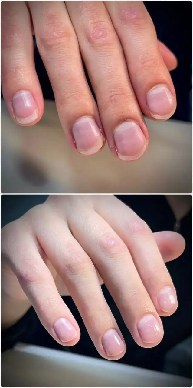Японский маникюр и восстановление натуральных ногтей в Ангарске - Маникюр (Услуги) в Ангарск