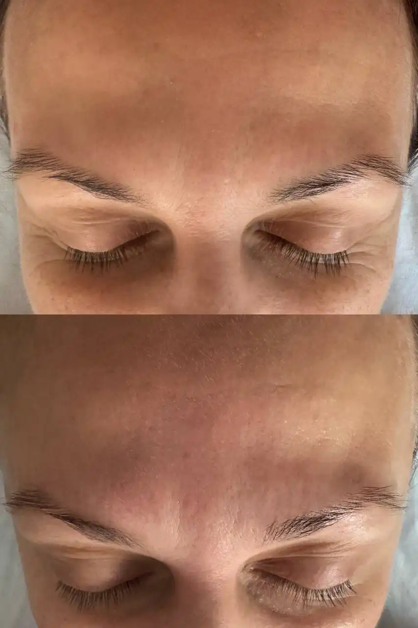 Миофасциальный массаж лица и головы