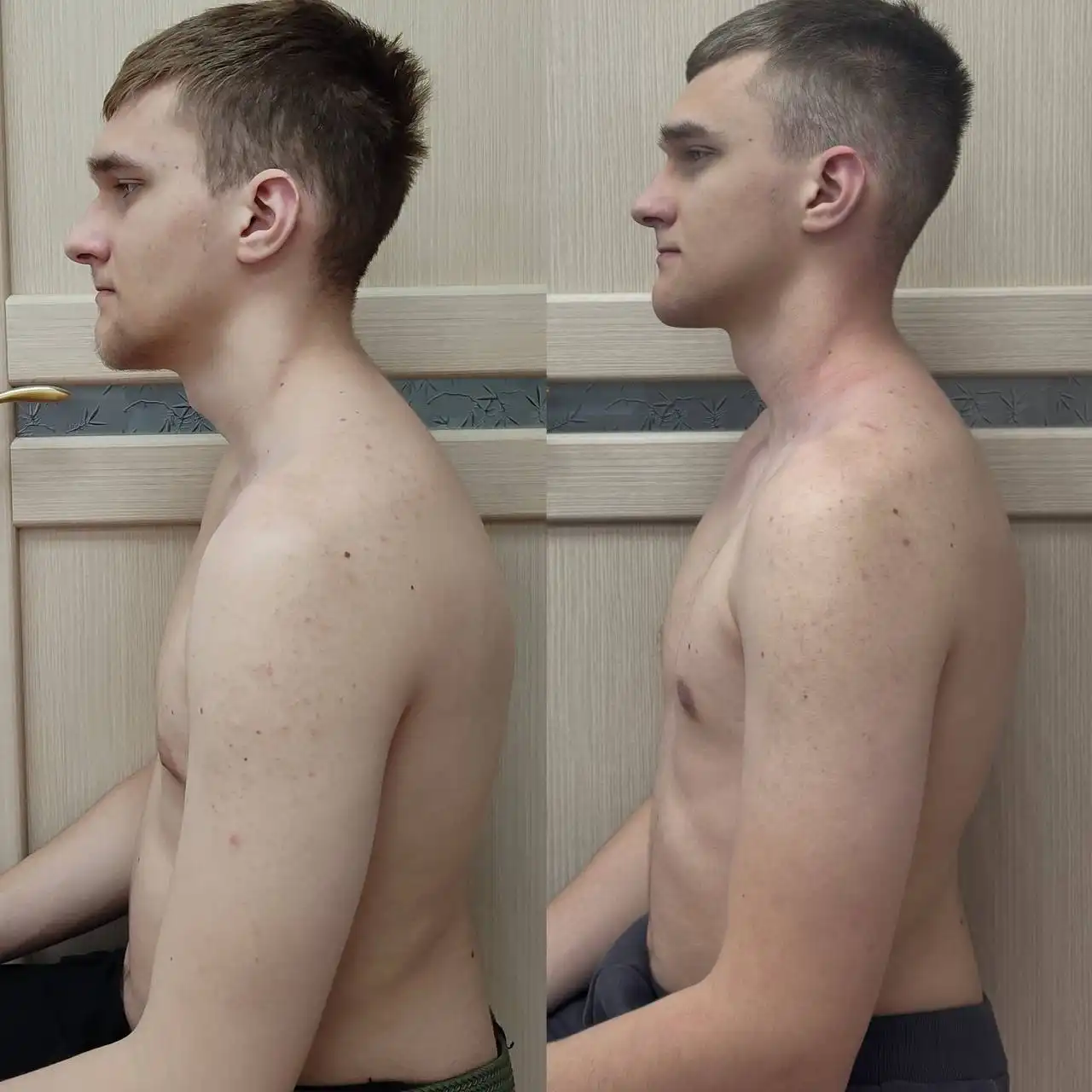 Миофасциальный массаж лица и головы