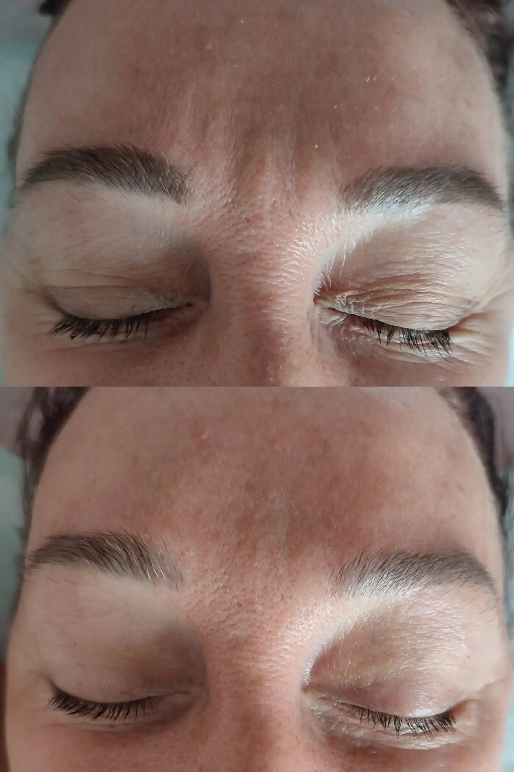 Миофасциальный массаж лица и головы - Массаж (Услуги) в Кемерово