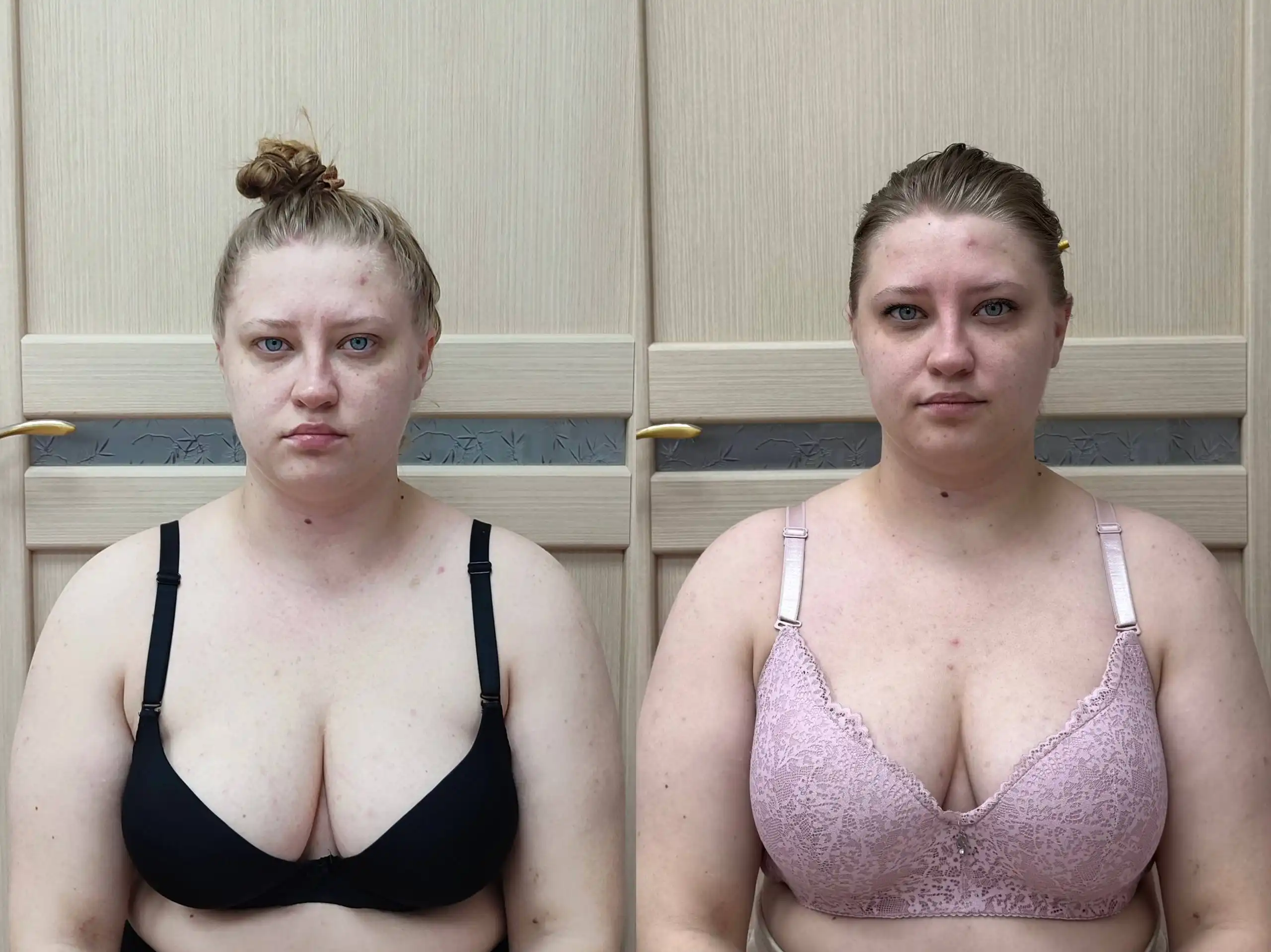 Миофасциальный массаж лица и головы - Массаж (Услуги) в Кемерово