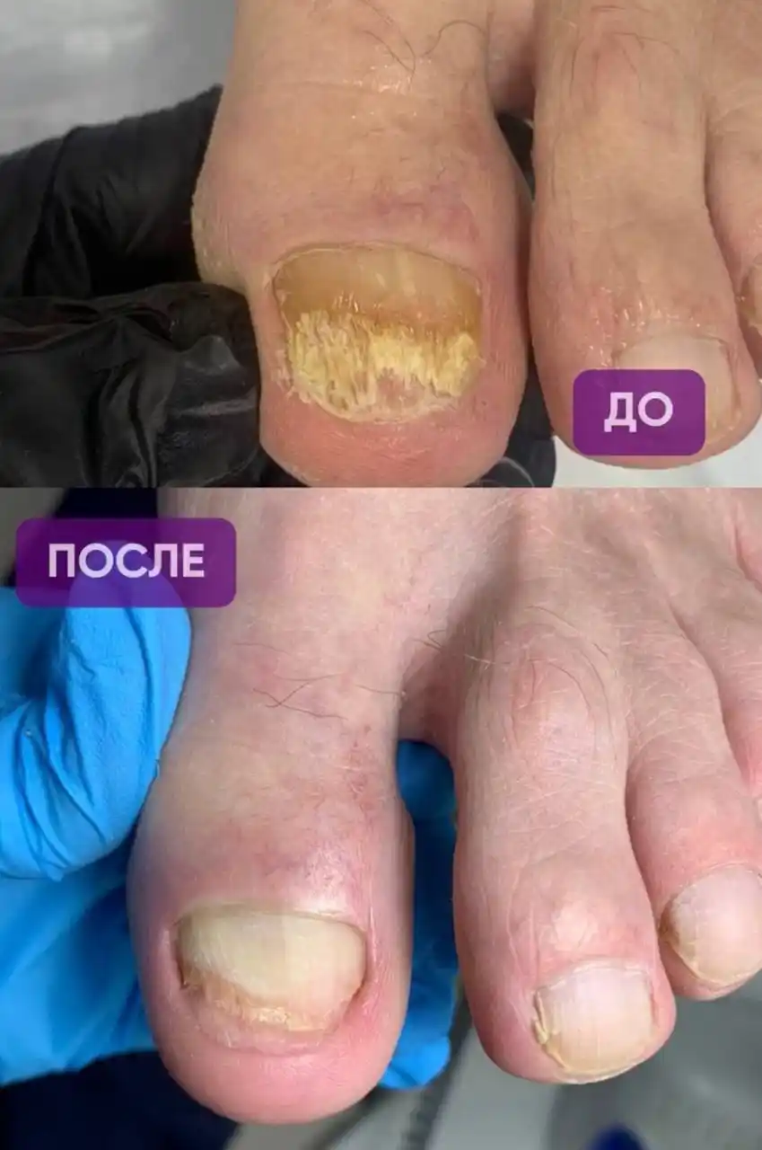 Когда обращаться к подологу - частное объявление в Саратов