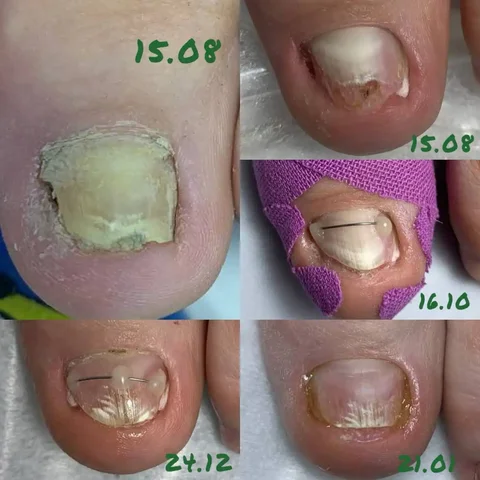 Студия НогтепилЪня в Саратове - Косметология в Саратов