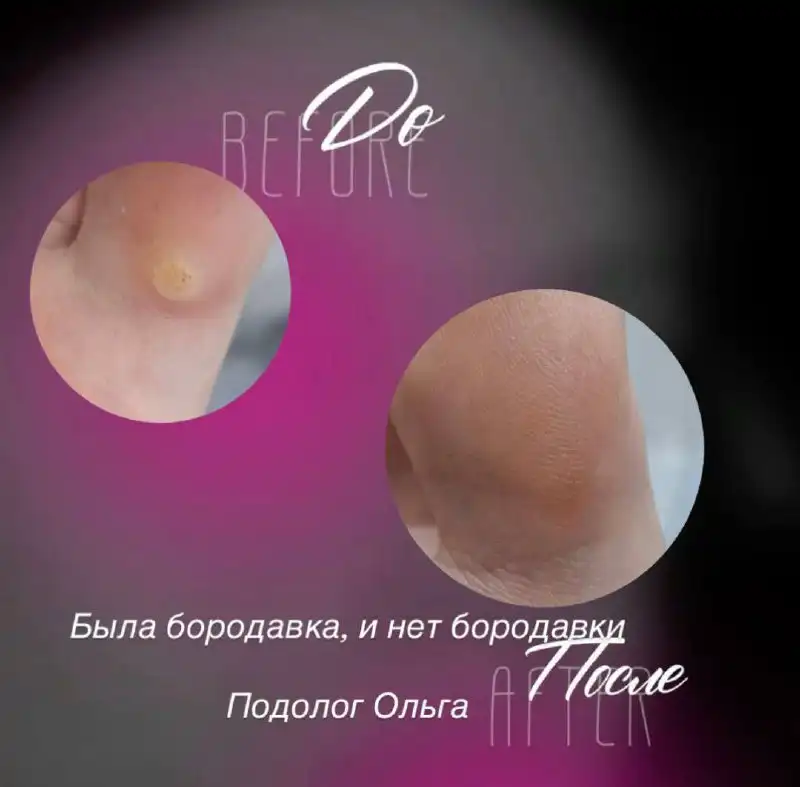 Услуги по решению проблем с ногами в Саратове - Медицинские услуги (Услуги) в Саратов