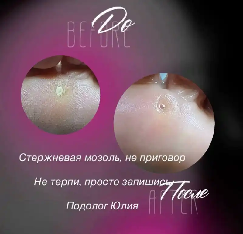 Услуги по решению проблем с ногами в Саратове - Медицинские услуги (Услуги) в Саратов