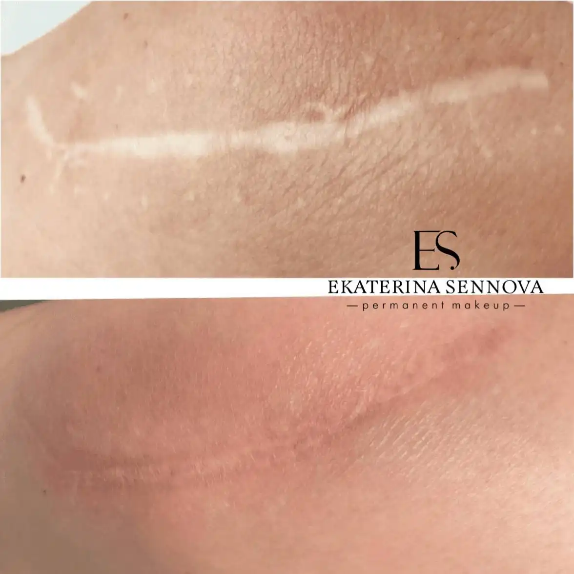 Эстетический камуфляж кожи в Нижнем Новгороде - Красота и здоровье (Услуги) в Нижний Новгород