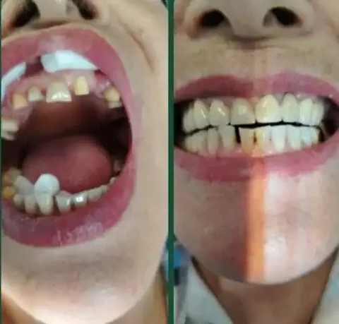 Стоматологические услуги к Новому году - частное объявление в Владимир