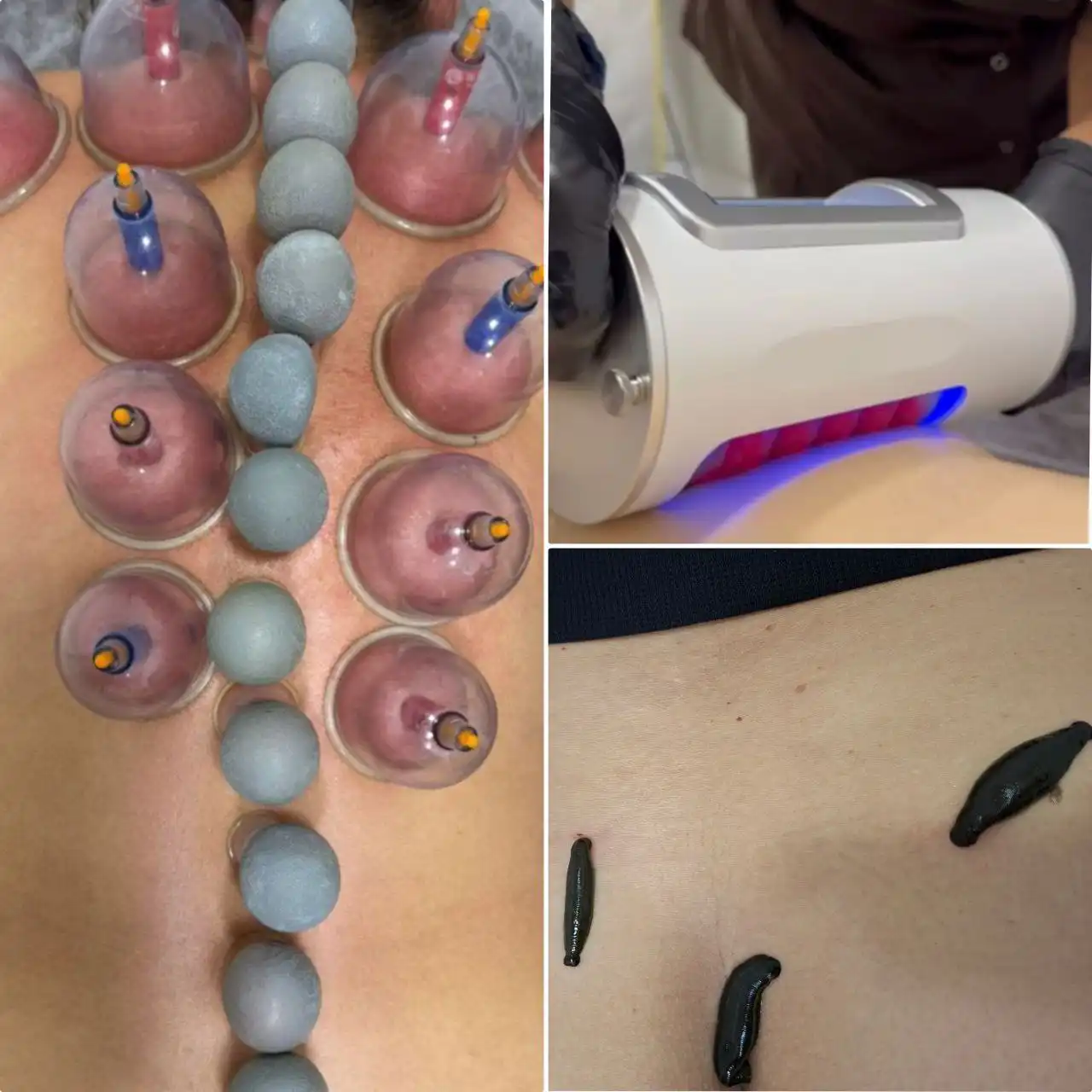 Массаж Гуаша с банками и аппаратный массаж Сфера - Массаж (Услуги) в Чита