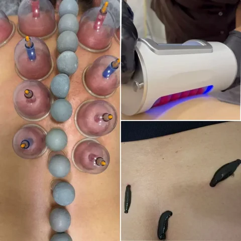 Услуги аппарата ГУАША и СФЕРА для лечения и профилактики заболеваний - Монтаж отопления в Чита