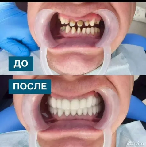 Лечение зубов и стоматологические услуги в Китае с полным сопровождением - частное объявление в Маньчжурия