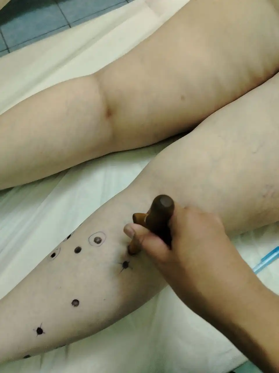 Услуги Баряашан: вправка позвоночника, лечение сколиоза, массаж простаты