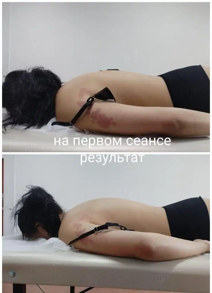 Услуги Баряашан: вправка позвоночника, лечение сколиоза, массаж простаты