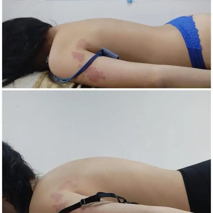 Услуги Баряашан: вправка позвоночника, лечение сколиоза, массаж простаты