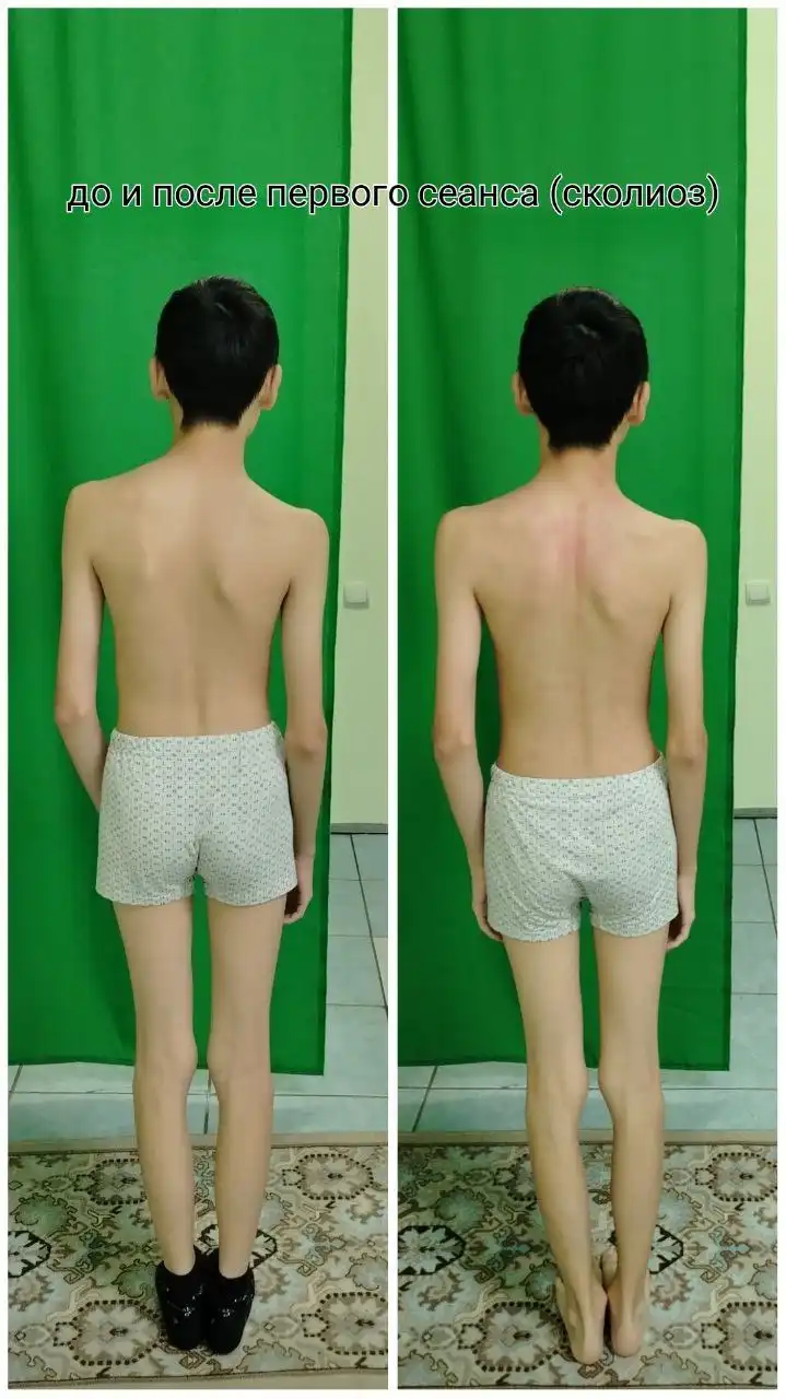 Услуги Баряашан: вправка позвоночника, лечение сколиоза, массаж простаты