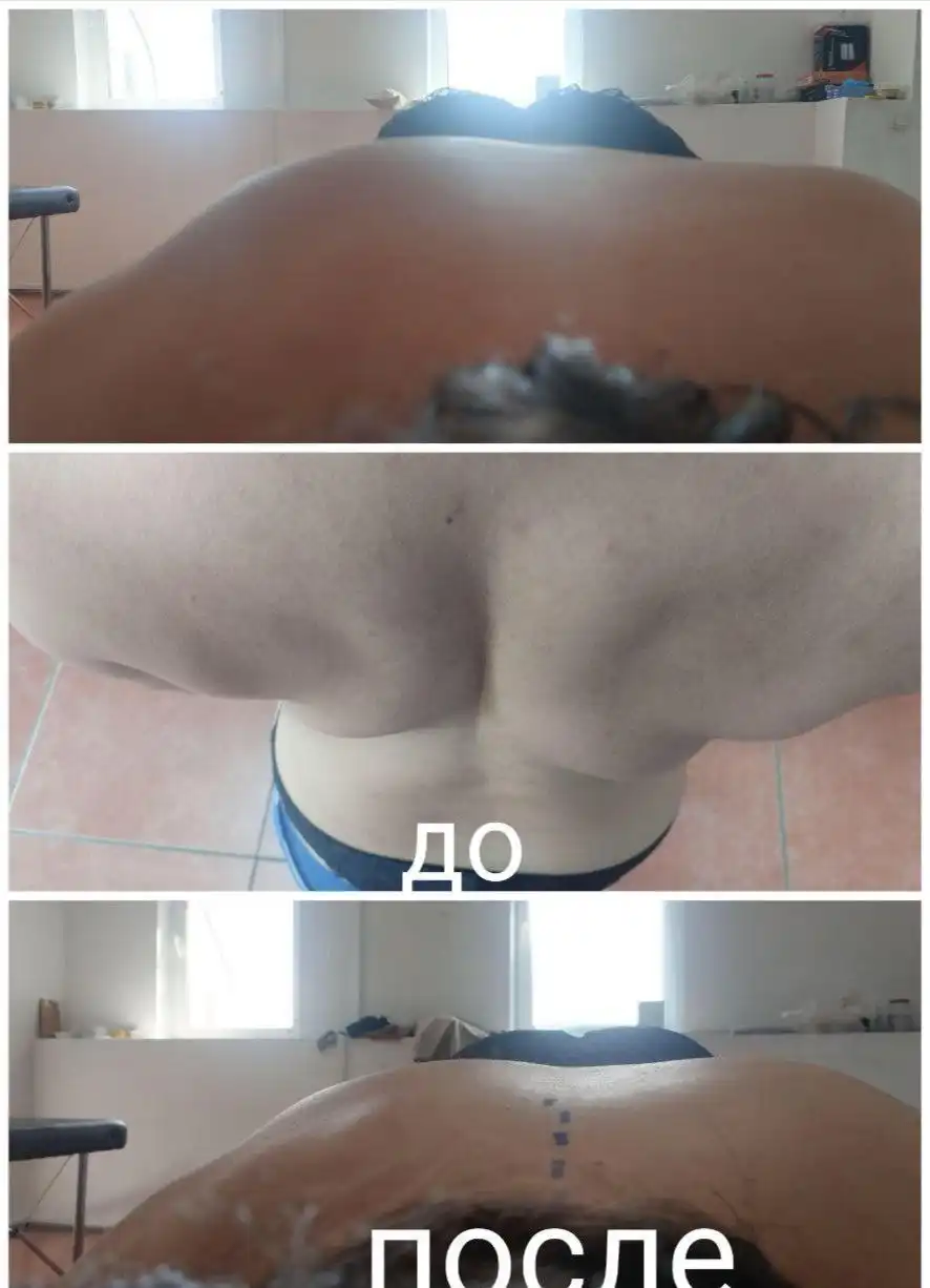 Услуги Баряашан: вправка позвоночника, лечение сколиоза, массаж простаты