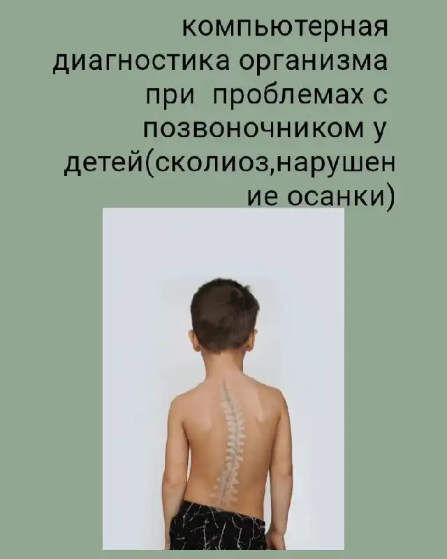 Компьютерная диагностика при проблемах с позвоночником у детей