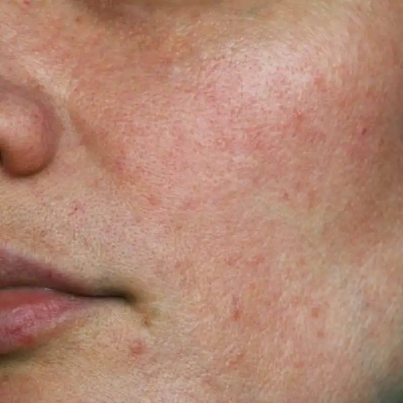 Комплексный чекап check-up для выявления причин проблем со здоровьем - Медицинские услуги (Услуги) в Красноярск