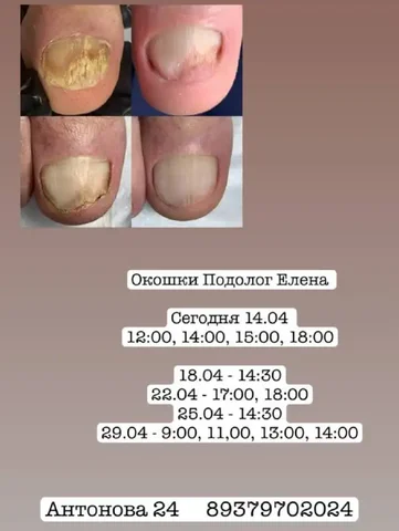 Услуги подолога в Энгельсе - Благоустройство участка в Энгельс