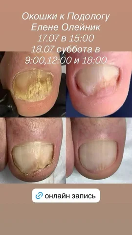 Услуги подолога - Услуги красоты в Саратов