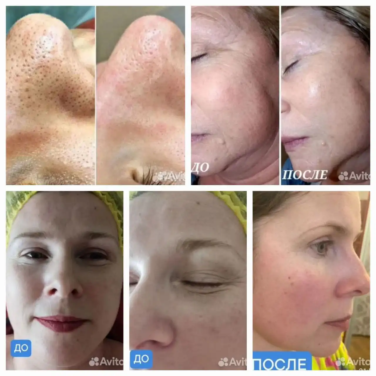 Услуги косметолога-эстетиста