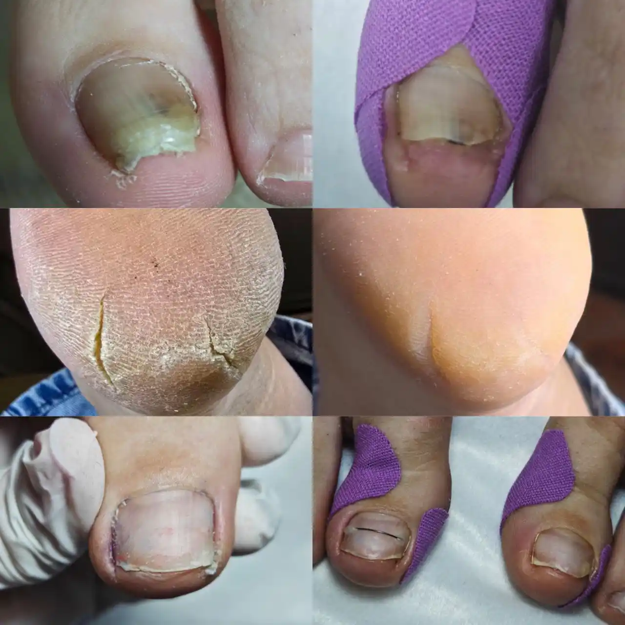 Маникюр и педикюр