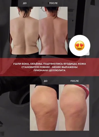 Аппаратный массаж для подтяжки кожи и устранения целлюлита - Услуги в Ангарск