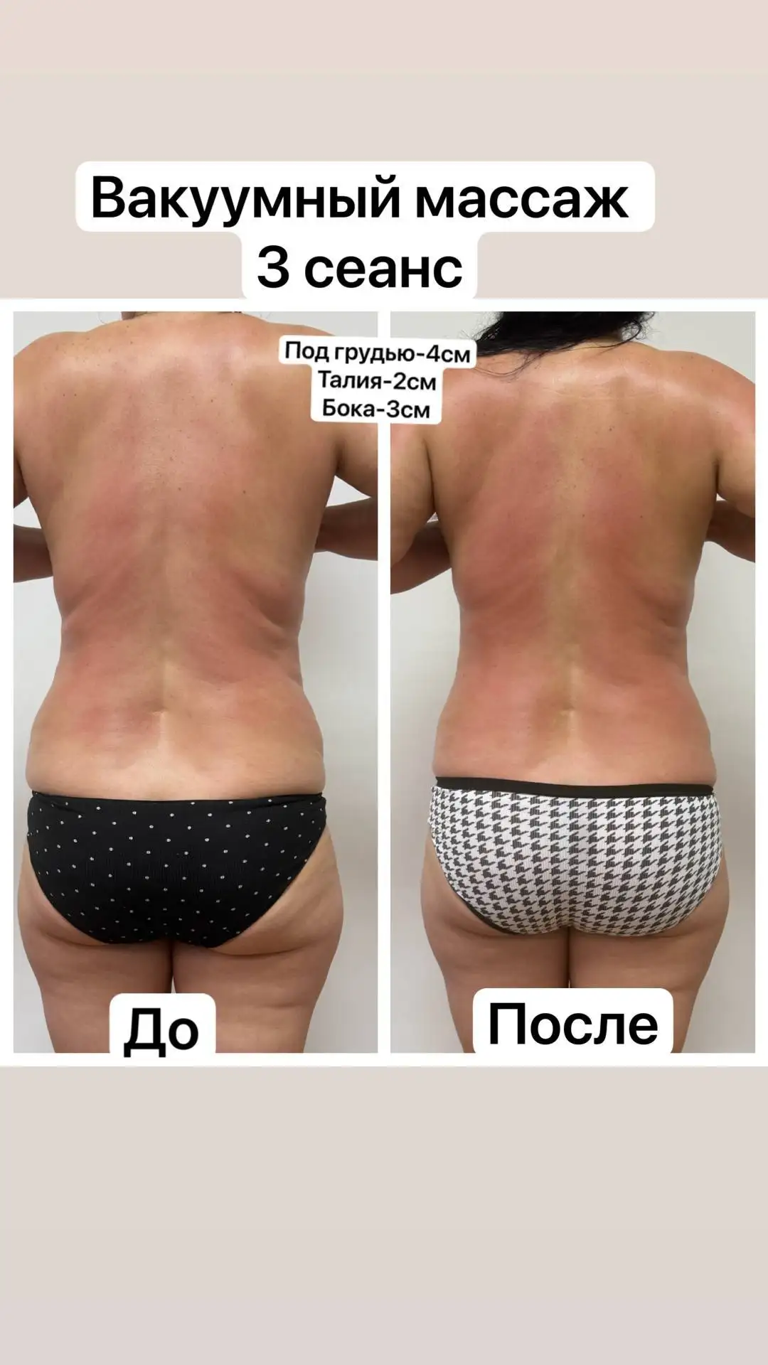 Аппаратный массаж для подтянутого тела - Массаж (Услуги) в Чебоксары