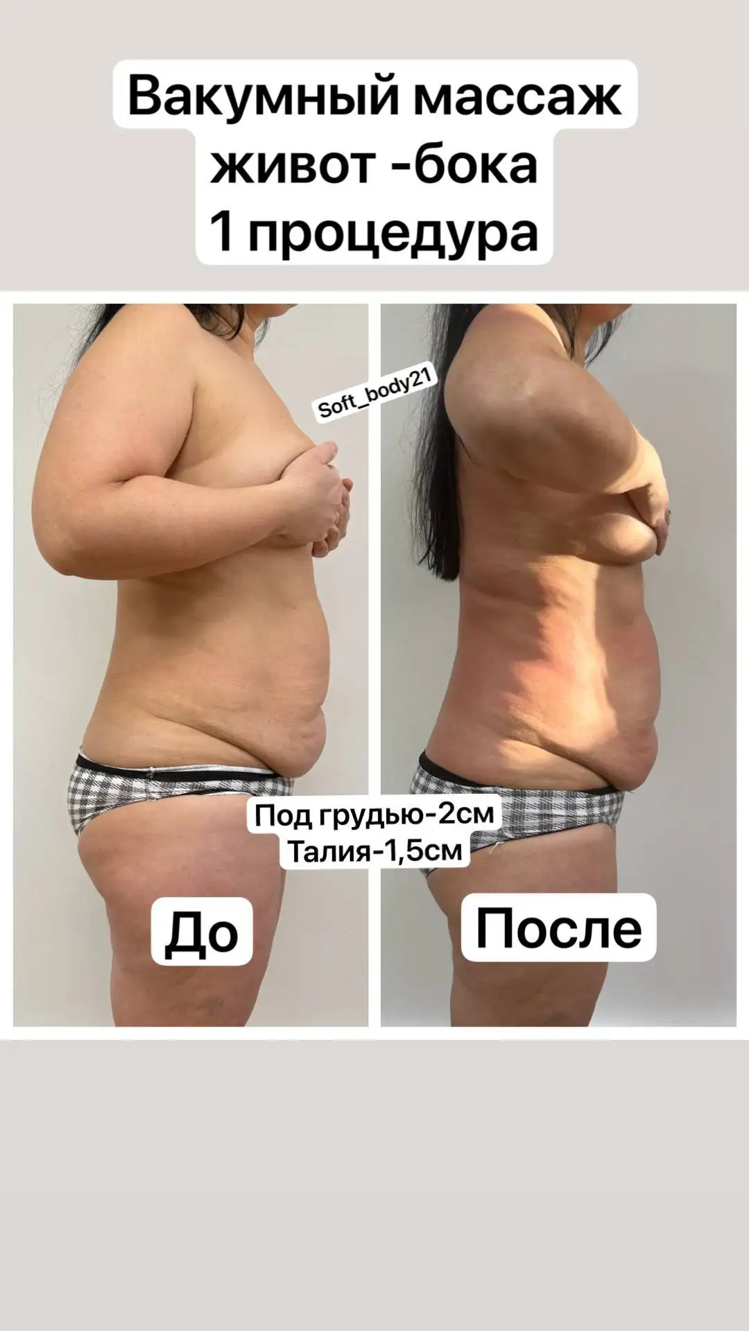 Аппаратный массаж для подтянутого тела - Массаж (Услуги) в Чебоксары