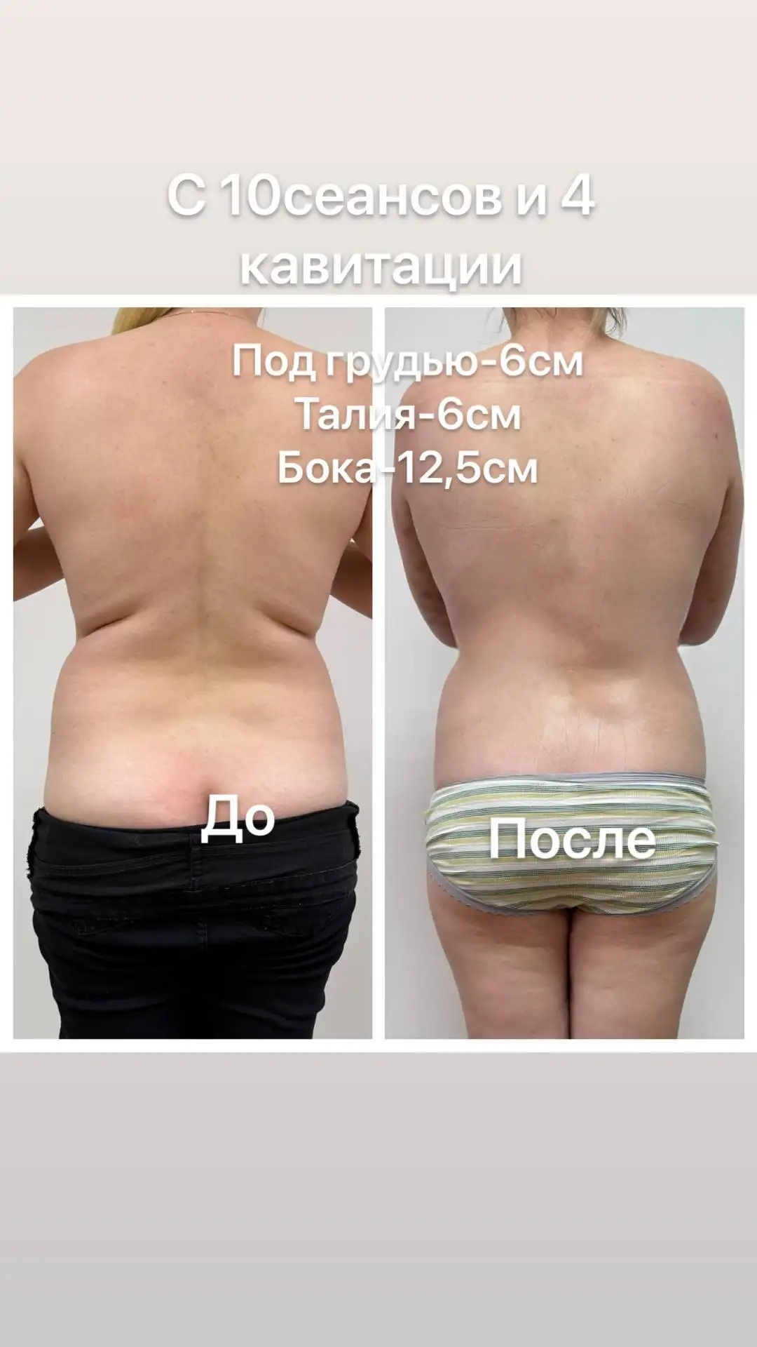 Аппаратный массаж: красота и лёгкость без усилий - Массаж (Услуги) в Чебоксары