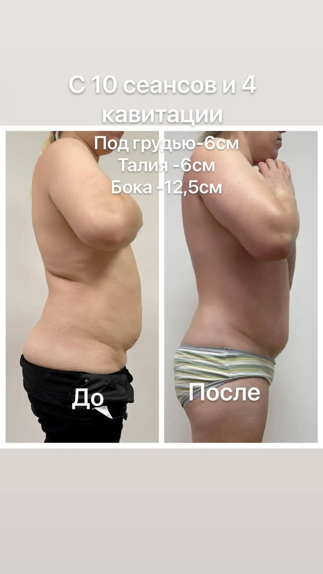 Аппаратный массаж: красота и лёгкость без усилий - Массаж (Услуги) в Чебоксары