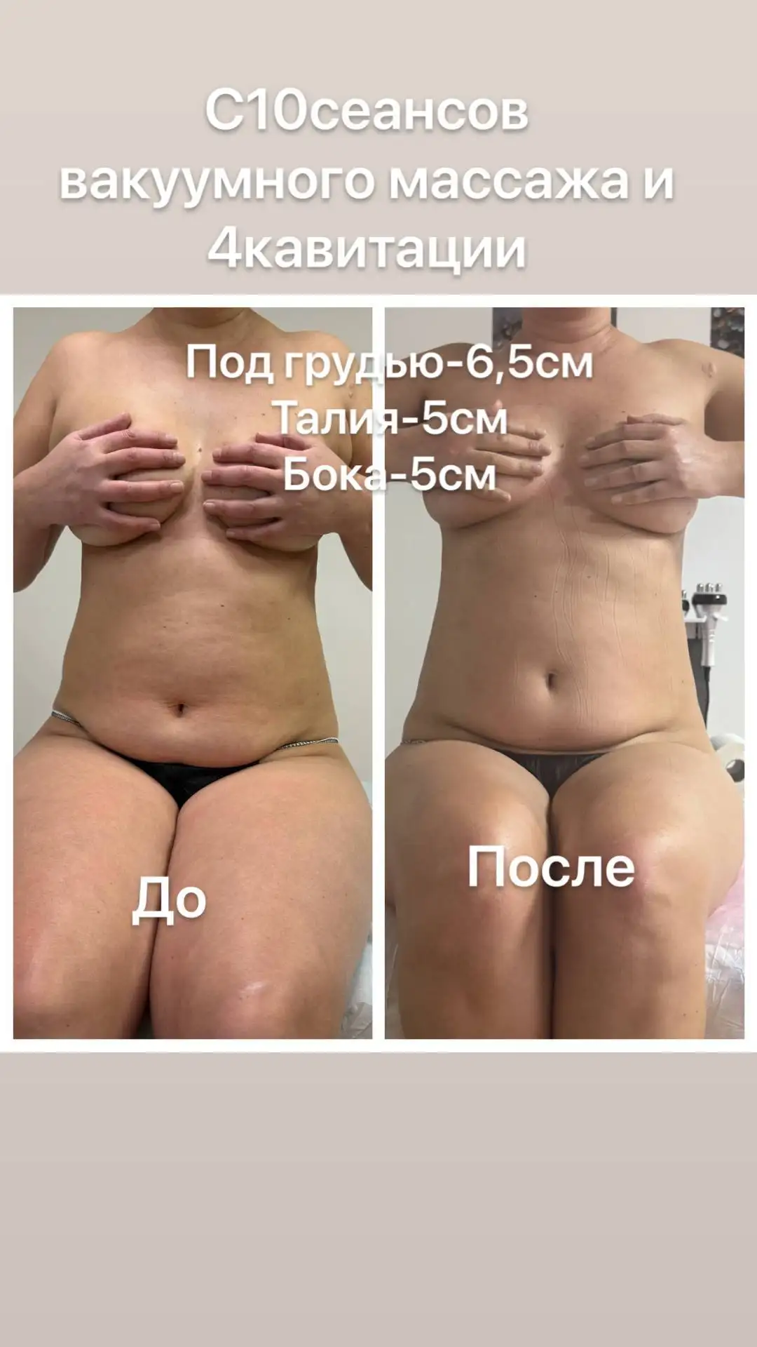 Аппаратный массаж: красота и лёгкость без усилий - Массаж (Услуги) в Чебоксары