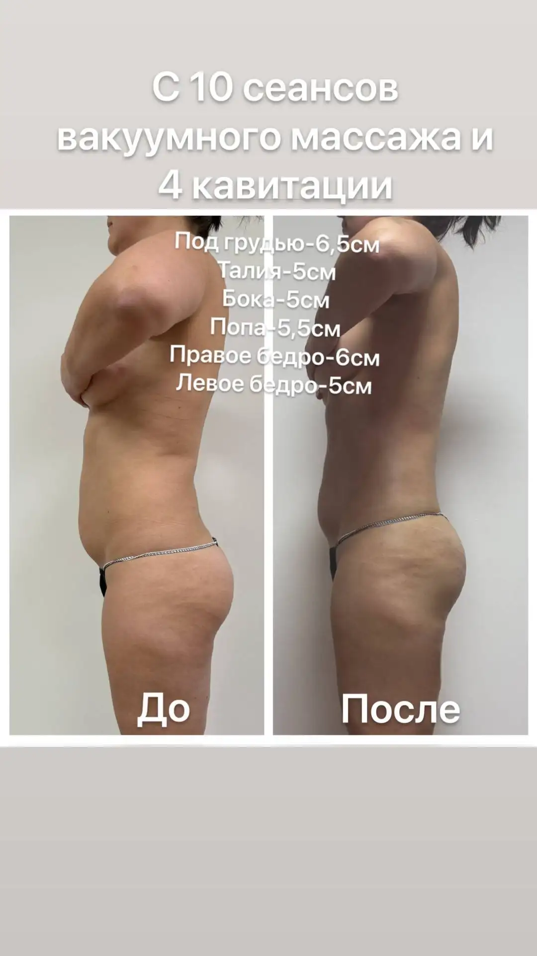 Аппаратный массаж: красота и лёгкость без усилий - Массаж (Услуги) в Чебоксары