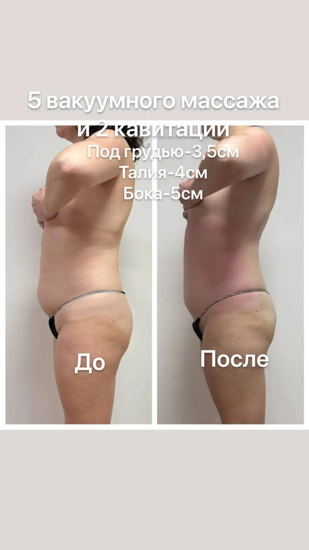 Аппаратный массаж: красота и лёгкость без усилий - Массаж (Услуги) в Чебоксары