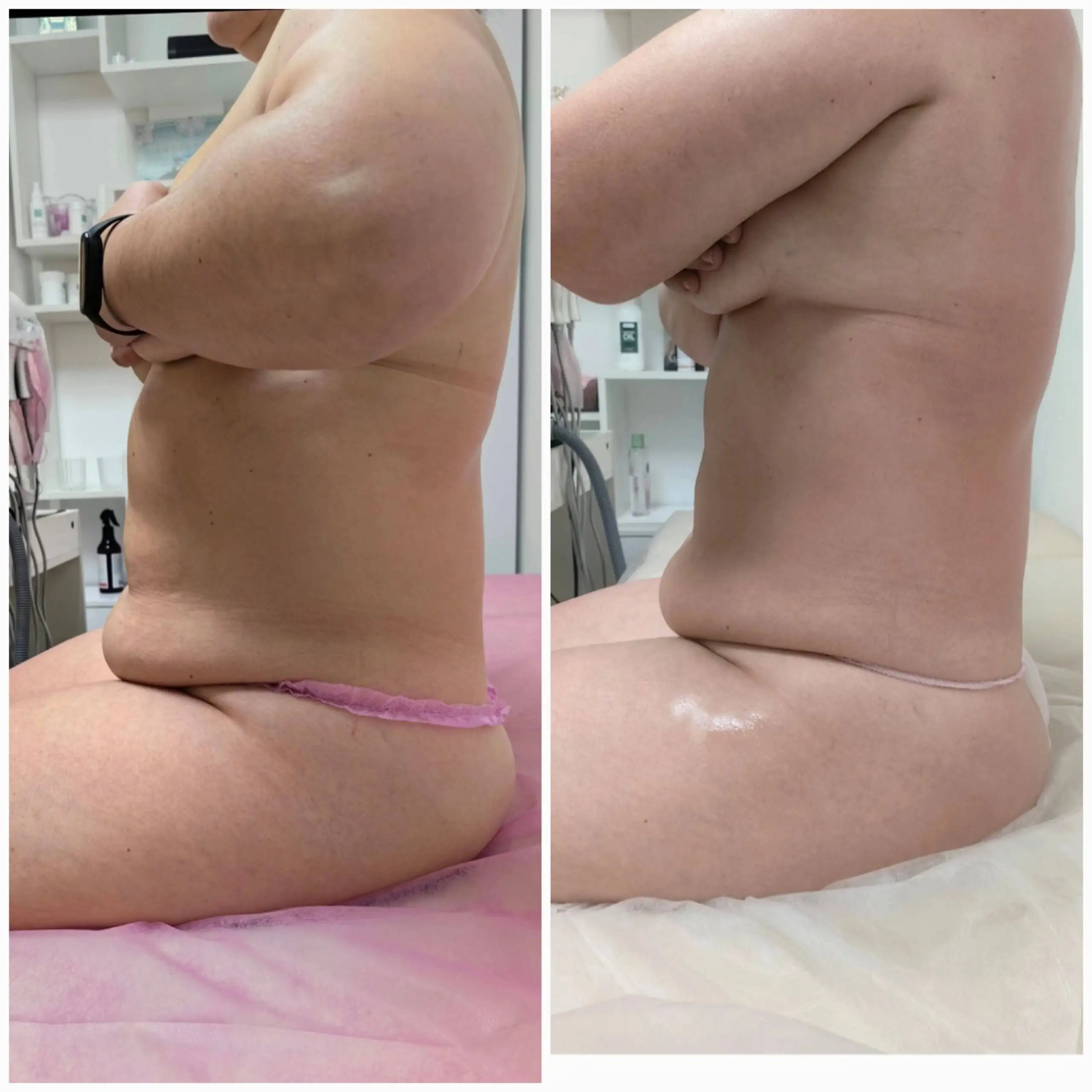 Весеннее преображение к красивой фигуре - Красота и здоровье (Услуги) в Чебоксары