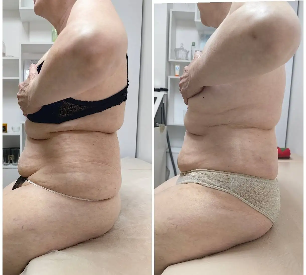 Весеннее преображение к красивой фигуре - Красота и здоровье (Услуги) в Чебоксары