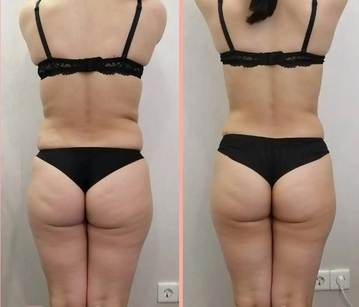 Весеннее преображение к красивой фигуре - Красота и здоровье (Услуги) в Чебоксары