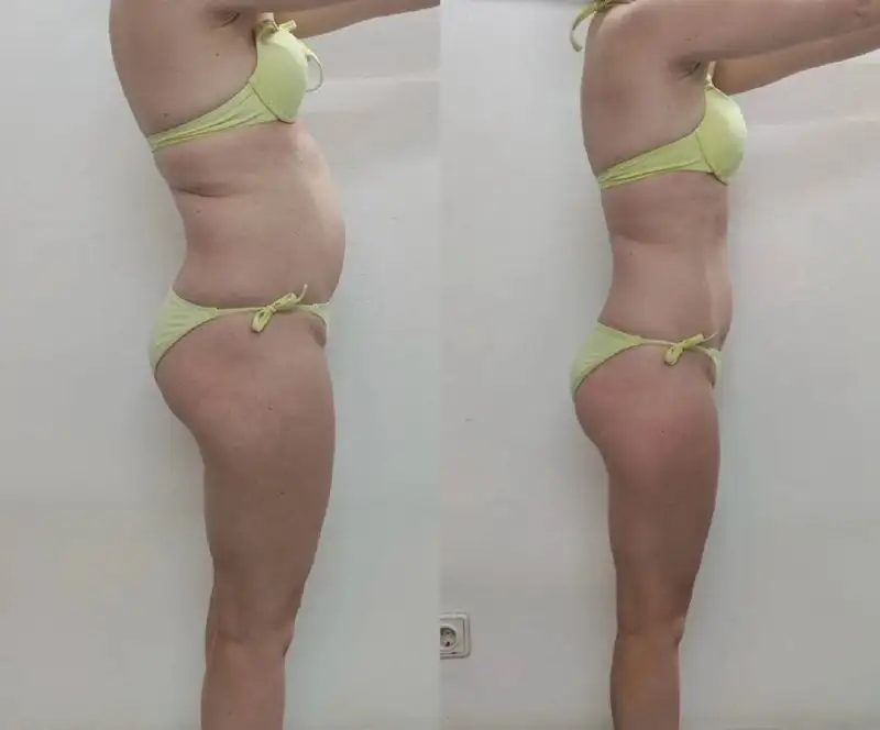 Весеннее преображение к красивой фигуре - Красота и здоровье (Услуги) в Чебоксары