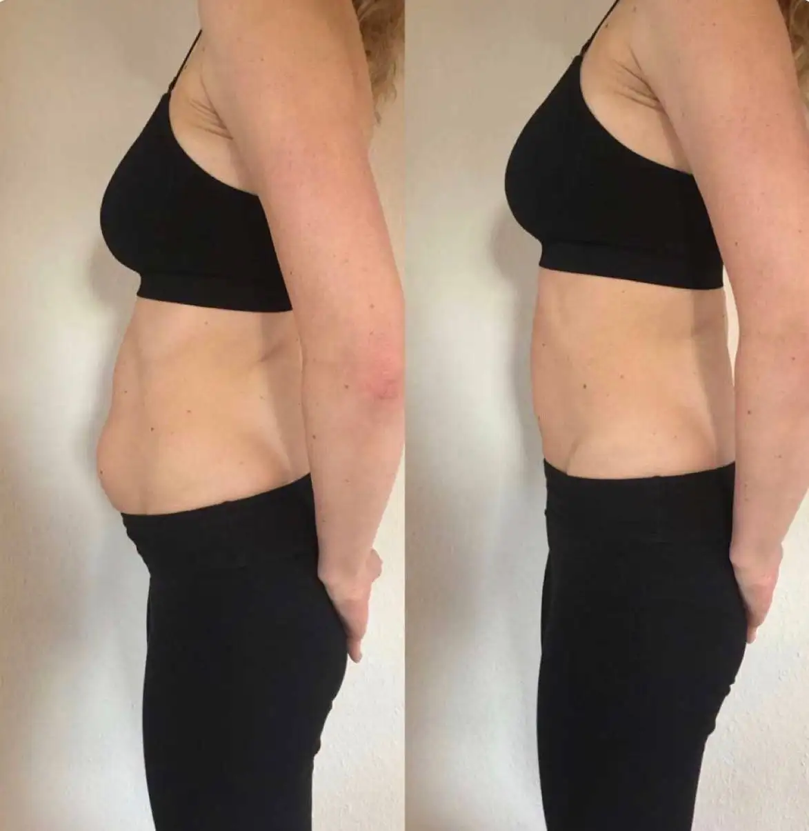 Весеннее преображение к красивой фигуре - Красота и здоровье (Услуги) в Чебоксары