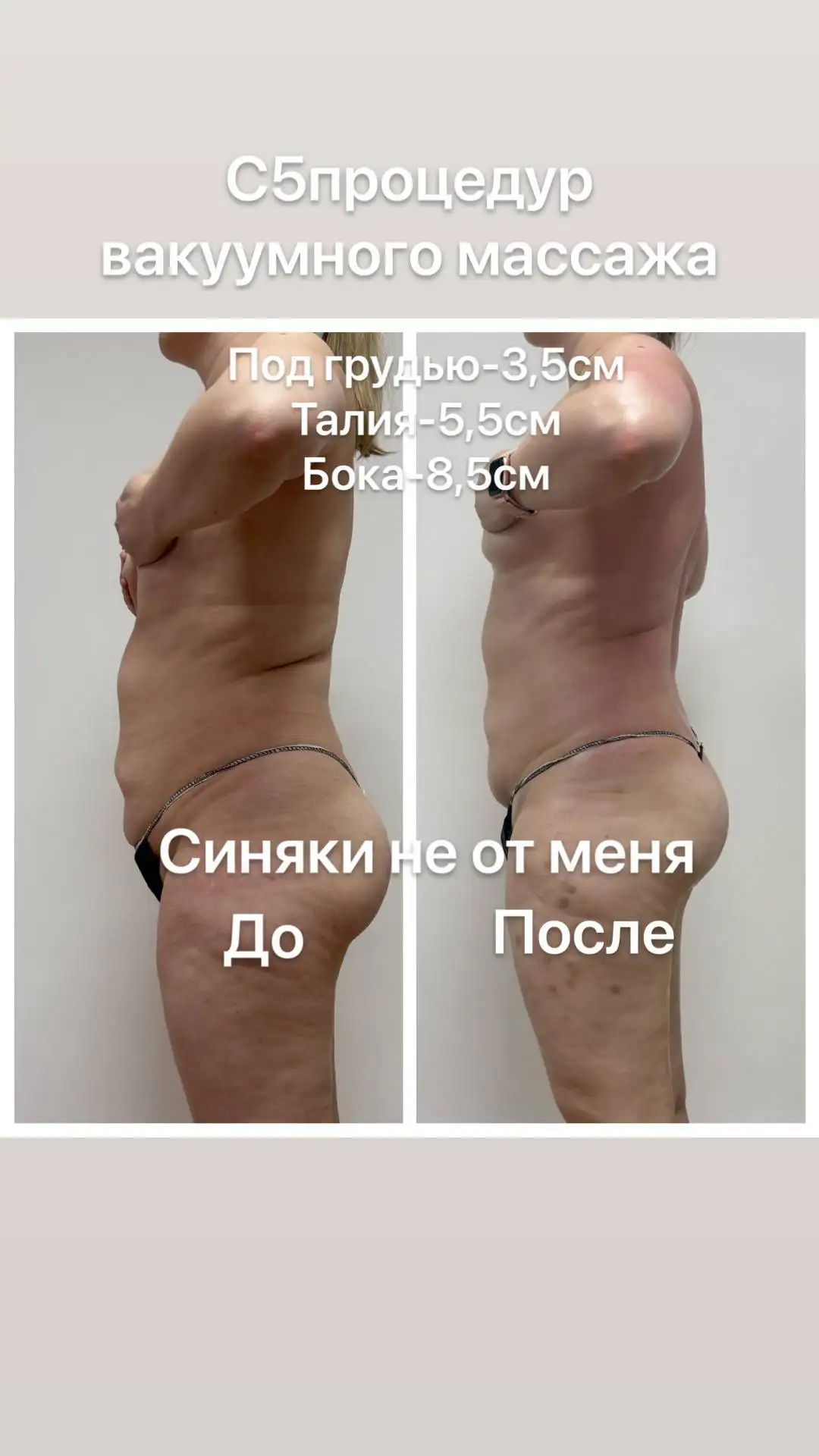 Весеннее преображение к красивой фигуре - Красота и здоровье (Услуги) в Чебоксары