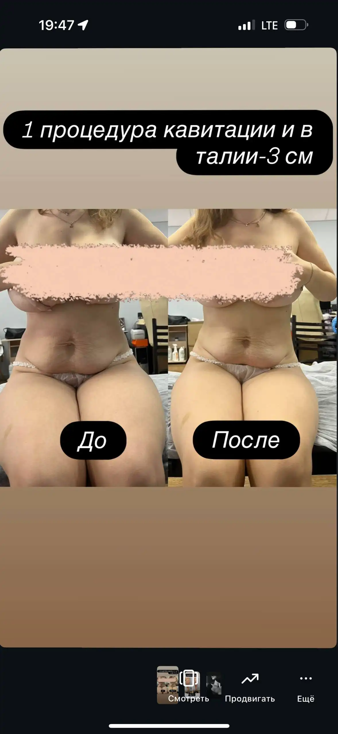 Аппаратный массаж для женщин - Автоуслуги в Чебоксары