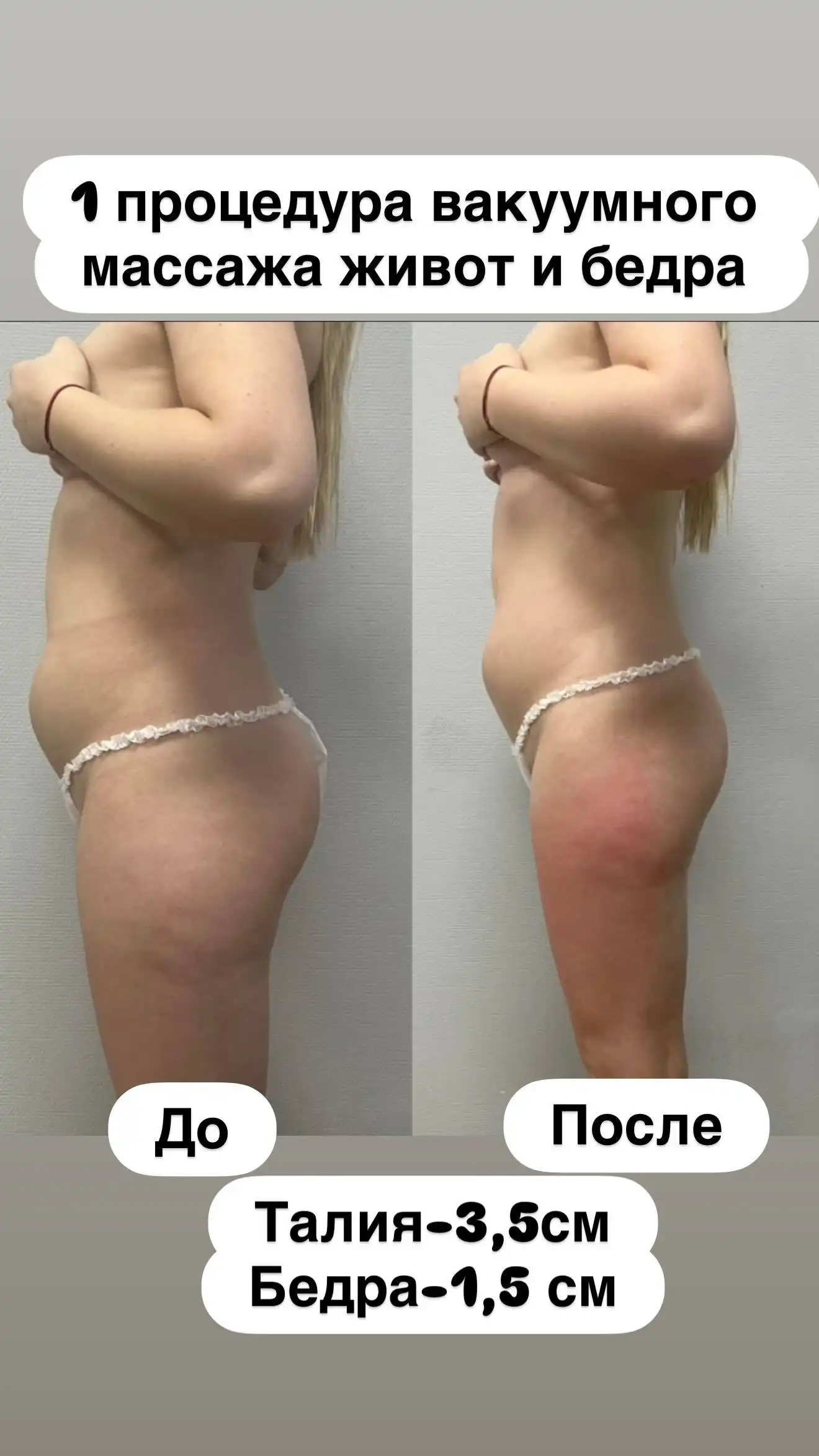 Аппаратный массаж для женщин - Массаж (Услуги) в Чебоксары