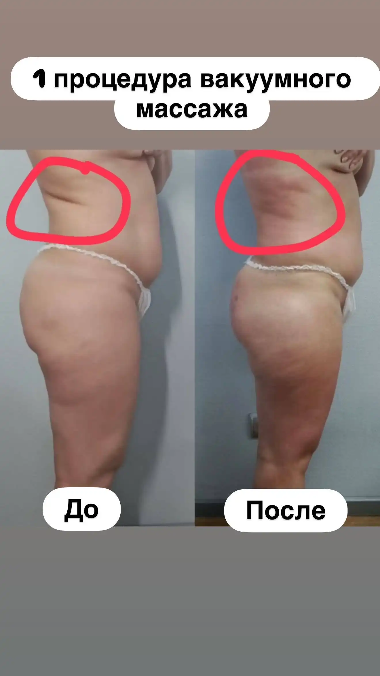 Аппаратный массаж для женщин - Массаж (Услуги) в Чебоксары