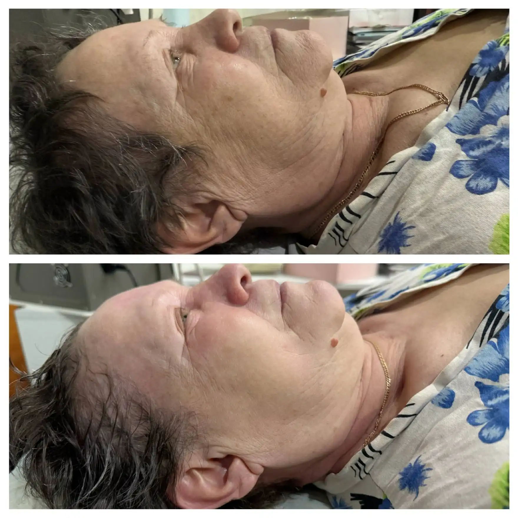 Аппаратный массаж для женщин - Массаж (Услуги) в Чебоксары