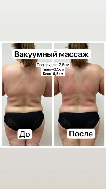 Аппаратный массаж: красота и лёгкость без усилий - Обучение в Чебоксары