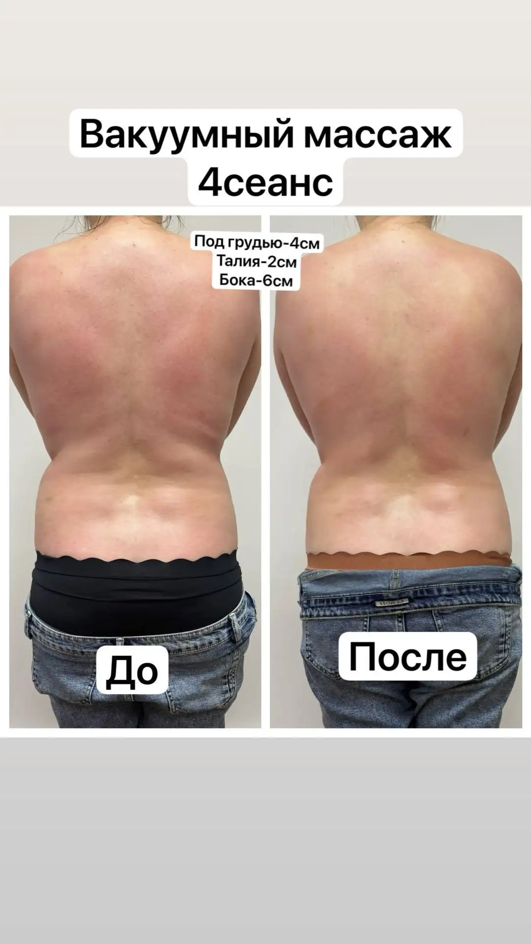 Аппаратный массаж: красота и лёгкость без усилий - Массаж (Услуги) в Чебоксары